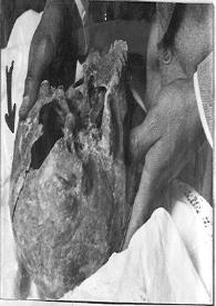 Fotografía del cráneo de Hernán Cortés al exhumarse | Biblioteca Virtual Miguel de Cervantes